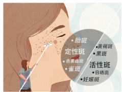熙凝颜带你了解斑的形成