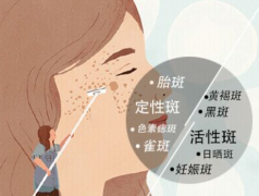 熙凝颜带你如何祛斑