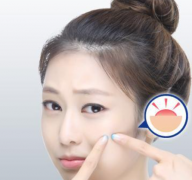 吃什么可以有效放防止晒斑那？熙凝颜告诉你